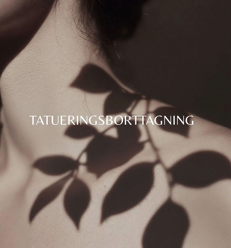 Tatueringsborttagning